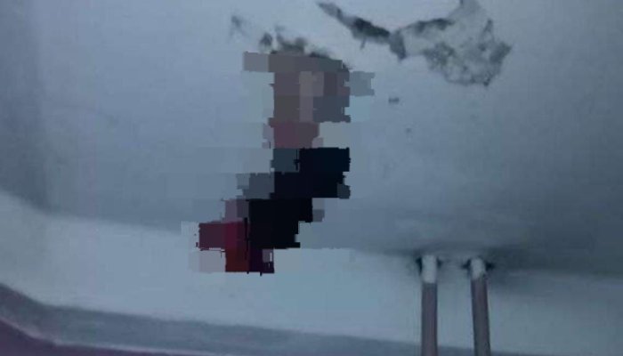 Иркутянка в подъезде своего дома провалилась в дыру, образовавшуюся между этажами