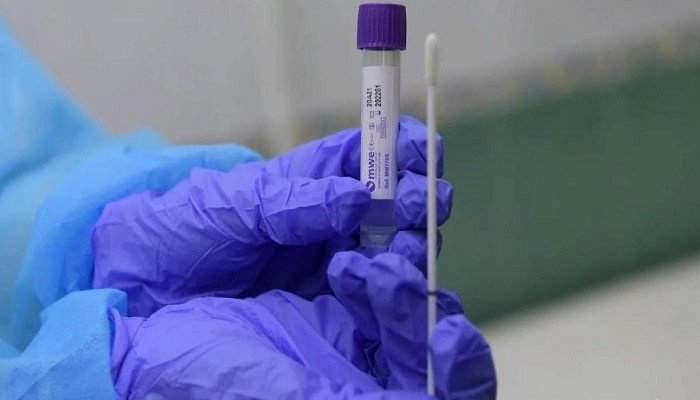 240 жителей Иркутской области заболели коронавирусом за неделю