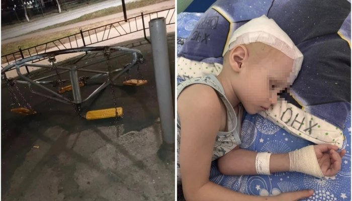 В Усолье-Сибирском качели проломили ребенку череп