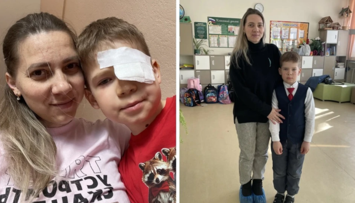 В Иркутске собака укусила первоклассника за лицо