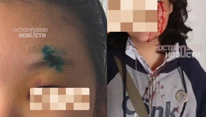 Две москвички избили 14-летнюю гостью из Бурятии самокатом