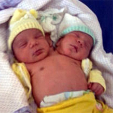 В Бразилии родился двухголовый малы
