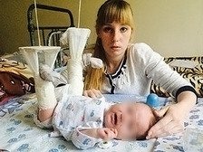 В Приморье хирург поломал ноги новорожденному ребенк