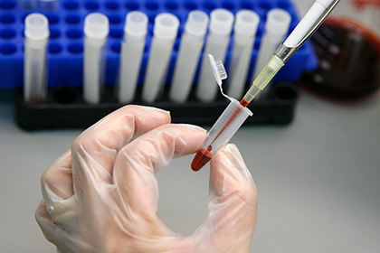 Препарат, подавляющий развитие ВИЧ, впервые успешно испытали на людях