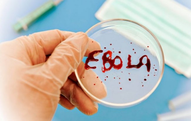 В Японии госпитализирован мужчина с подозрением на вирус Эбола