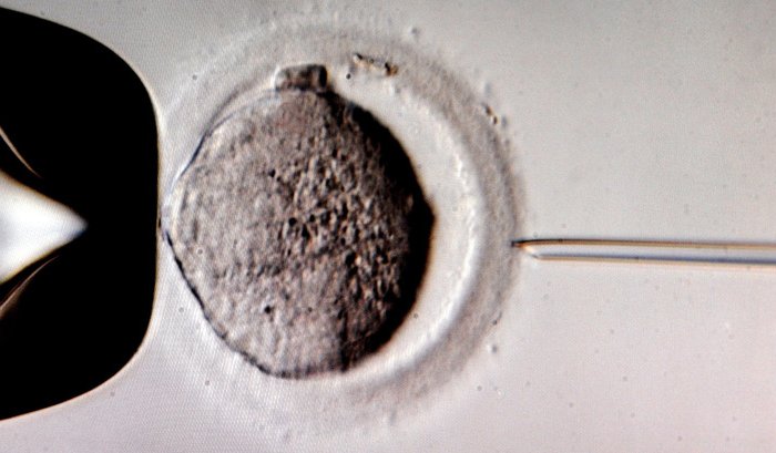 В США разрешат генетические эксперименты по зачатию детей от трех родителей