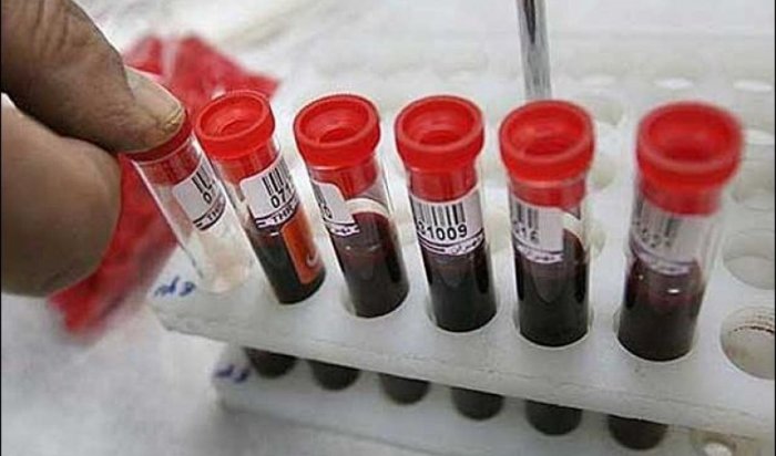 СМИ сообщили об эпидемии ВИЧ в Екатеринбурге