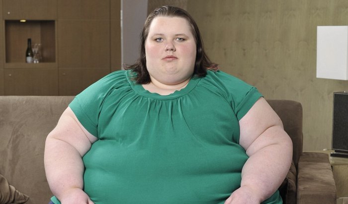 Заболеваемость ожирением выросла в России вдвое