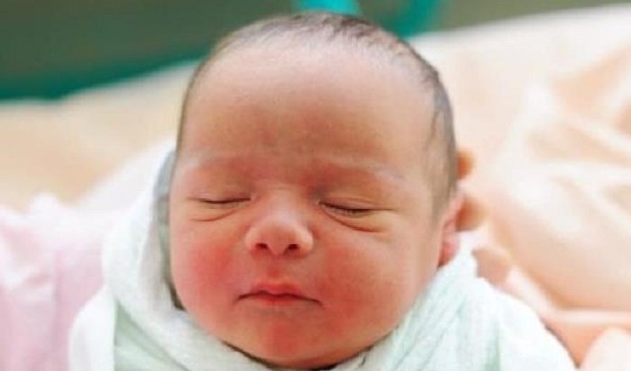 В Ангарске женщина родила ребенка во время операции по удалению аппендицита 31 декабря