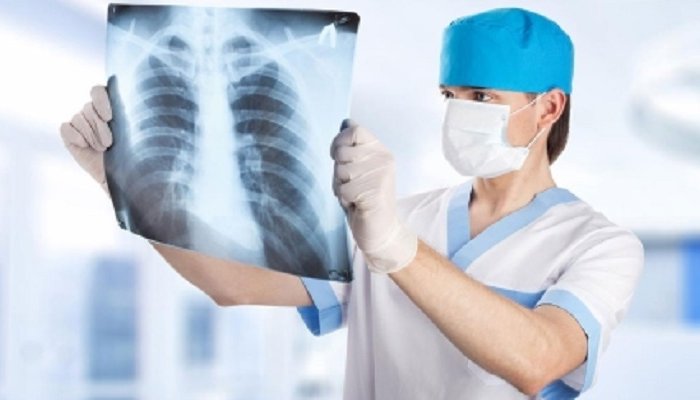В Иркутске отмечается снижение заболеваемости туберкулезом