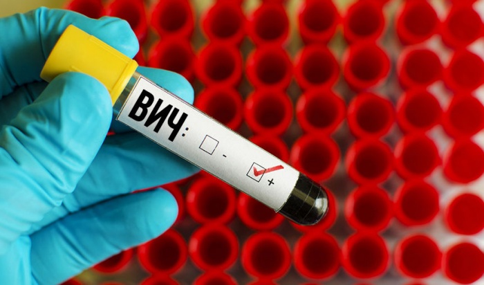Приговор суда иркутянину, заразившему ВИЧ-инфекцией возлюбленную, отменен