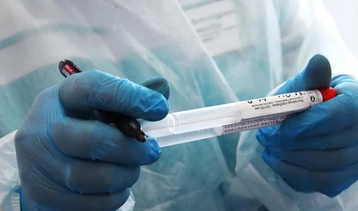 Роспотребнадзор: Тест на коронавирус скоро можно будет сдать на дому