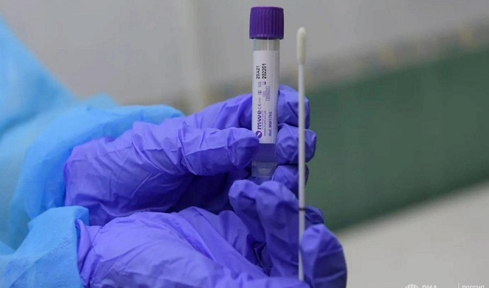 22 случая заболевания коронавирусом зарегистрировали в Иркутской области