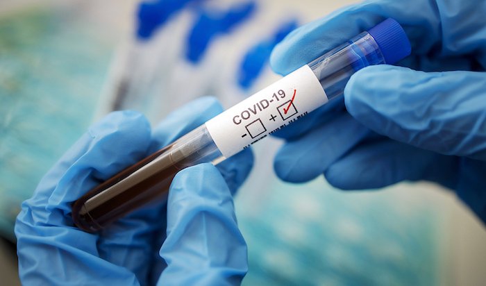Жители Иркутской области пройдут повторное тестирование на антитела к коронавирусу