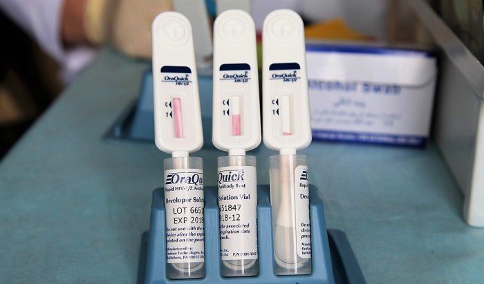 Бесплатное тестирование на ВИЧ пройдет в иркутских вузах