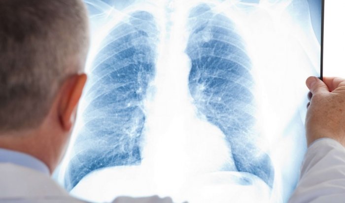 Главврач Иркутской туберкулезной больницы предупредил об ухудшении эпидситуации в регионе