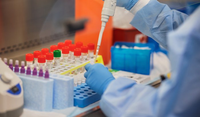 135 новых случаев COVID-19 подтвердили за сутки в Иркутской области